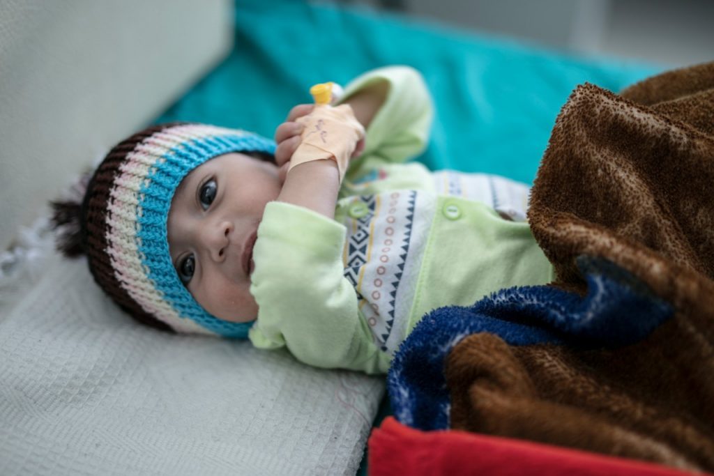 malnourished baby in Yemen hospital